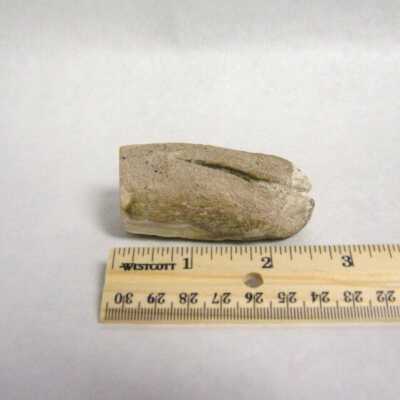 Limb Cast
