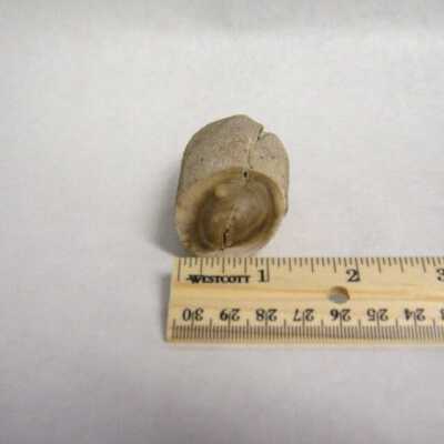 Limb Cast
