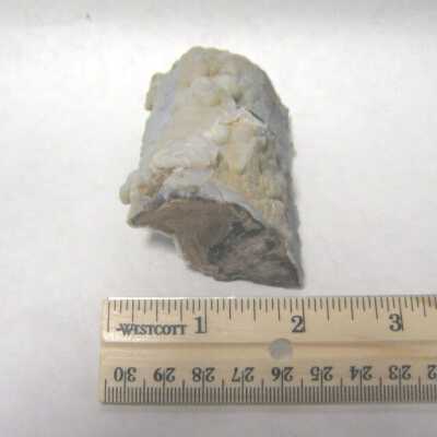Limb Cast