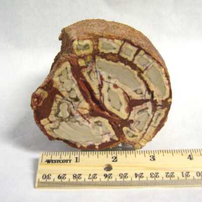 Limb Cast