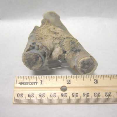 Limb Cast