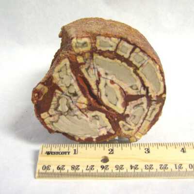 Limb Cast