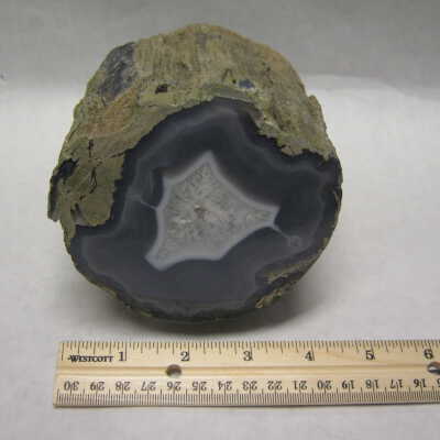 Limb Cast
