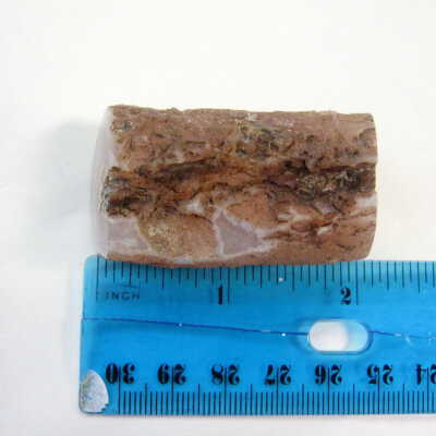 limb cast