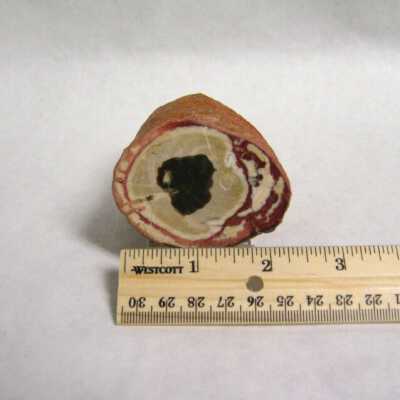 Limb Cast