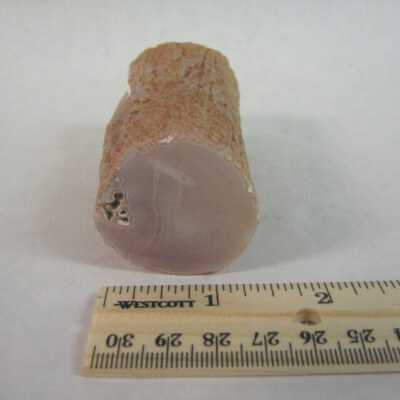 Limb Cast