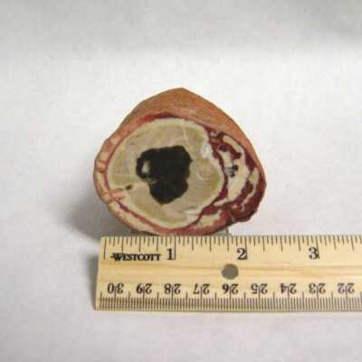 Limb Cast