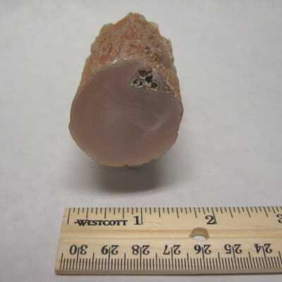 Limb Cast