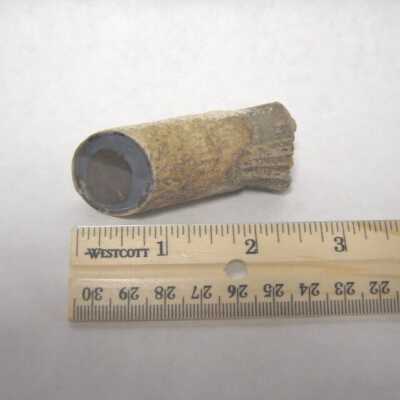 Limb Cast