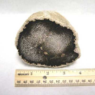 Limb Cast