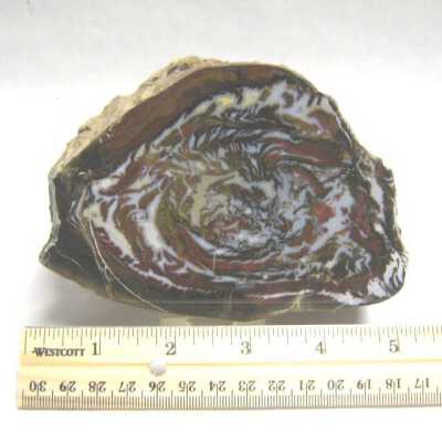 Limb Cast