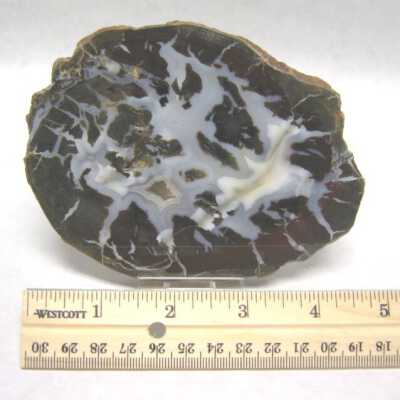 Limb Cast