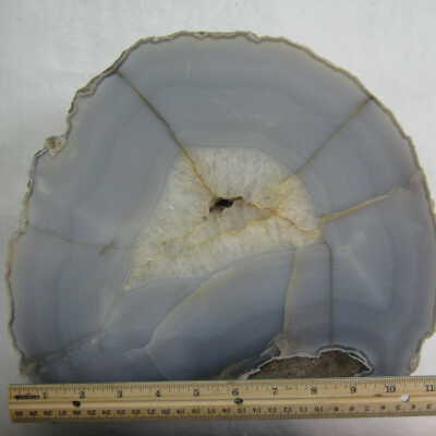 Limb Cast