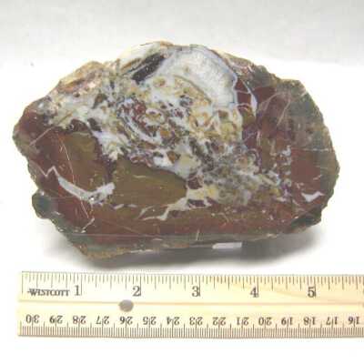 Limb Cast