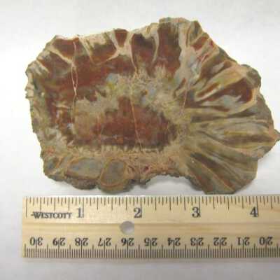 Limb Cast