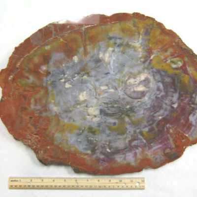 Limb Cast