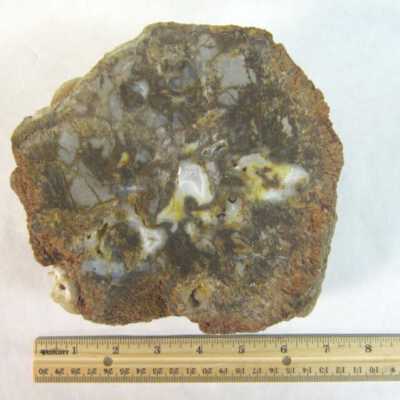 Limb Cast