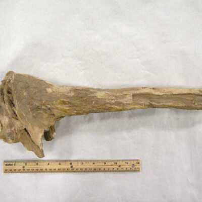 Limb Cast