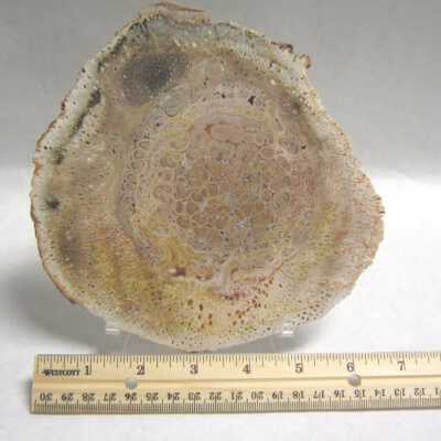 Limb Cast