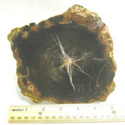 Limb Cast
