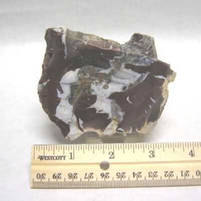 Limb Cast
