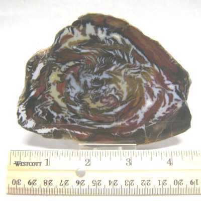 Limb Cast