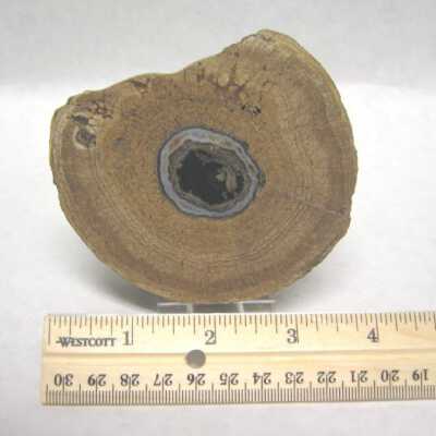 Limb Cast