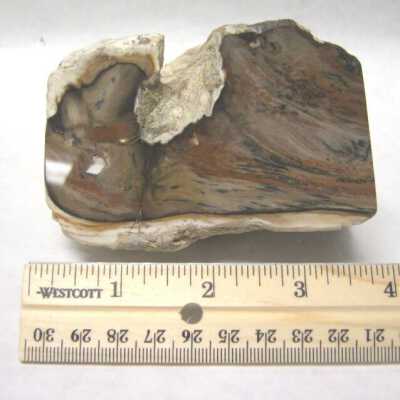Limb Cast