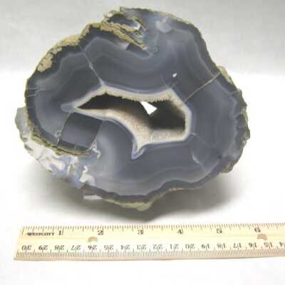 Limb Cast