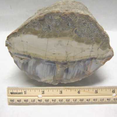 Limb Cast