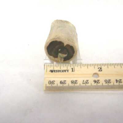Limb Cast