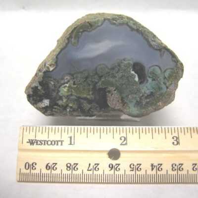 Limb Cast
