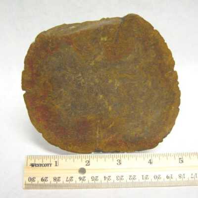Limb Cast