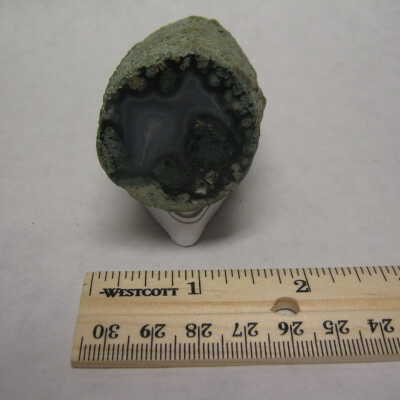 Limb Cast