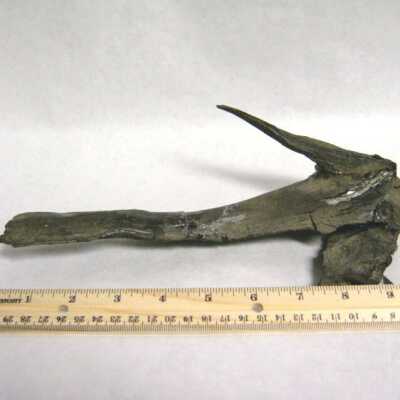 Limb Cast
