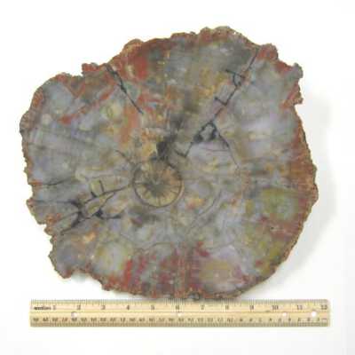 Limb Cast