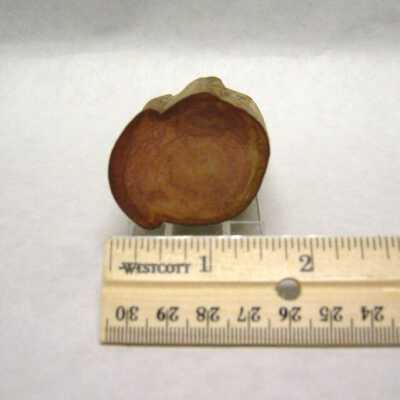 Limb Cast
