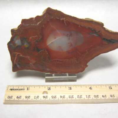 Limb Cast