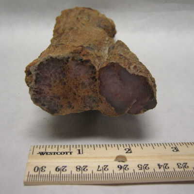 Limb Cast