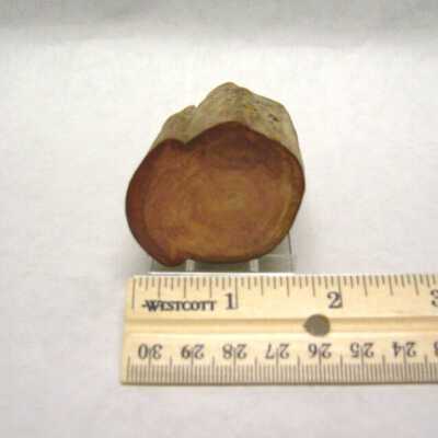 Limb Cast