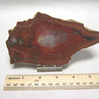 Limb Cast