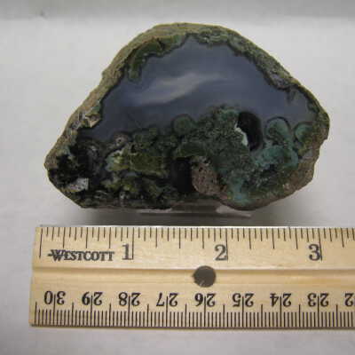 Limb Cast