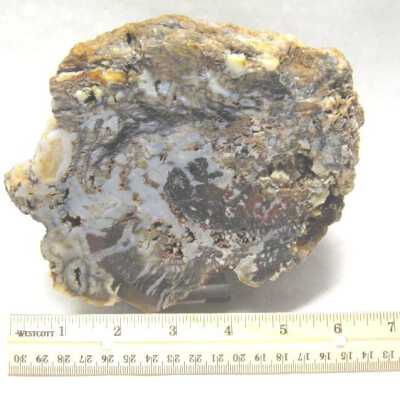 Limb Cast