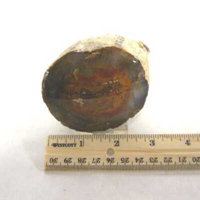 Limb Cast