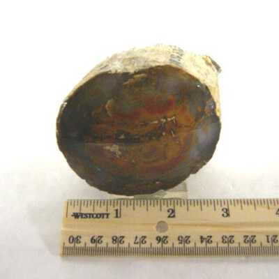 Limb Cast