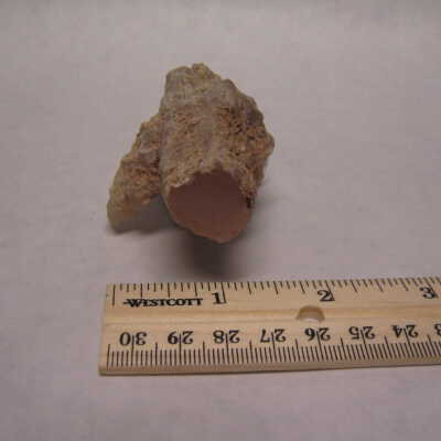 Limb Cast