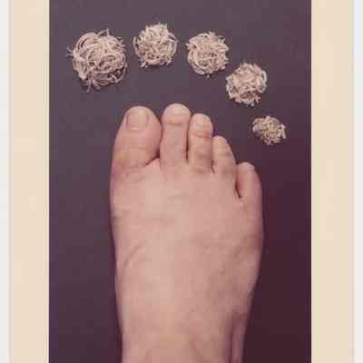 Nails - Foot