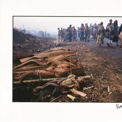 Refugee Victims of Cholera During Exodus from the Rwandan Genocide Crisis