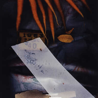 Carrotid Scan