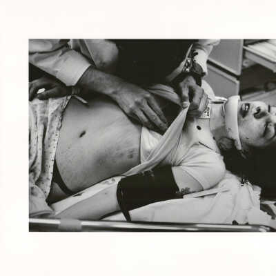 Diane with tire marks on her chest Minneapolis